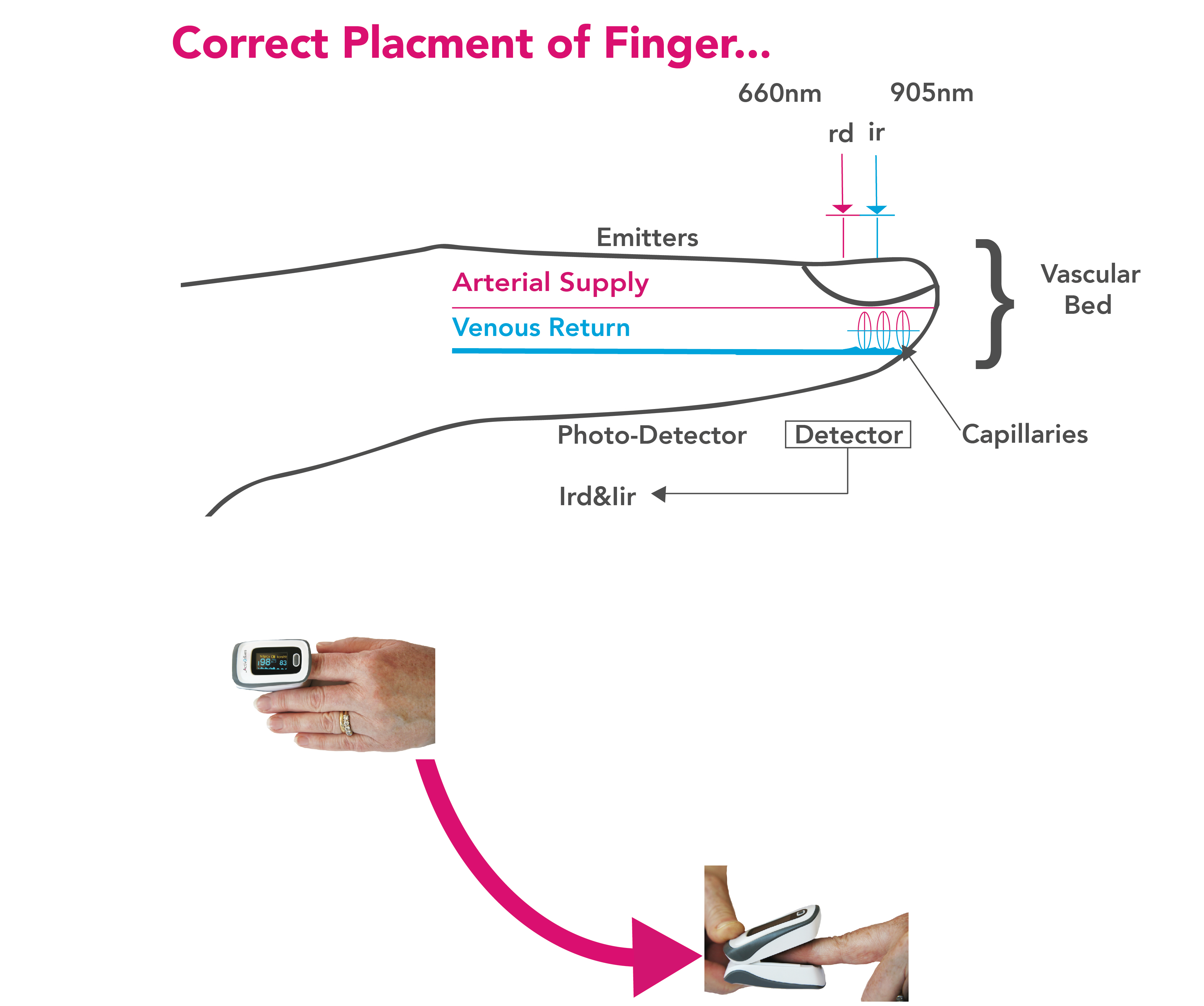 Blood Oxygen Saturation Pulse Oximetry